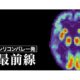 PET検査の脳画像で、AIがアルツハイマーをこれまでより6年早く予想